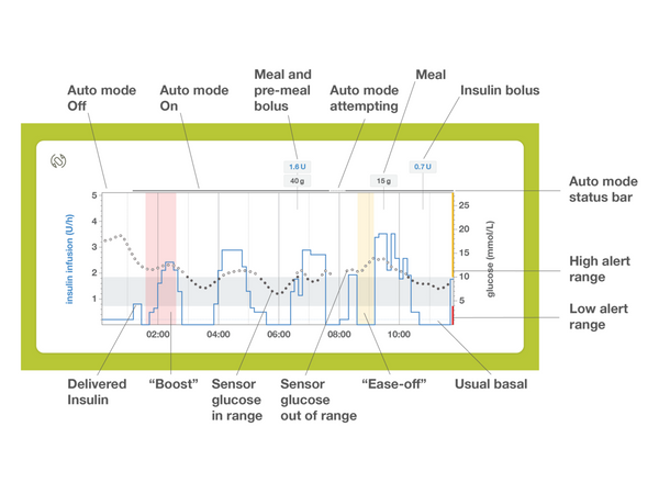Detailed graph (to view the detailed graph, rotate the home screen into landscape configuration or tap the “screen rotation” icon).